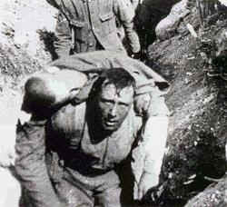 injured ww1 soldier